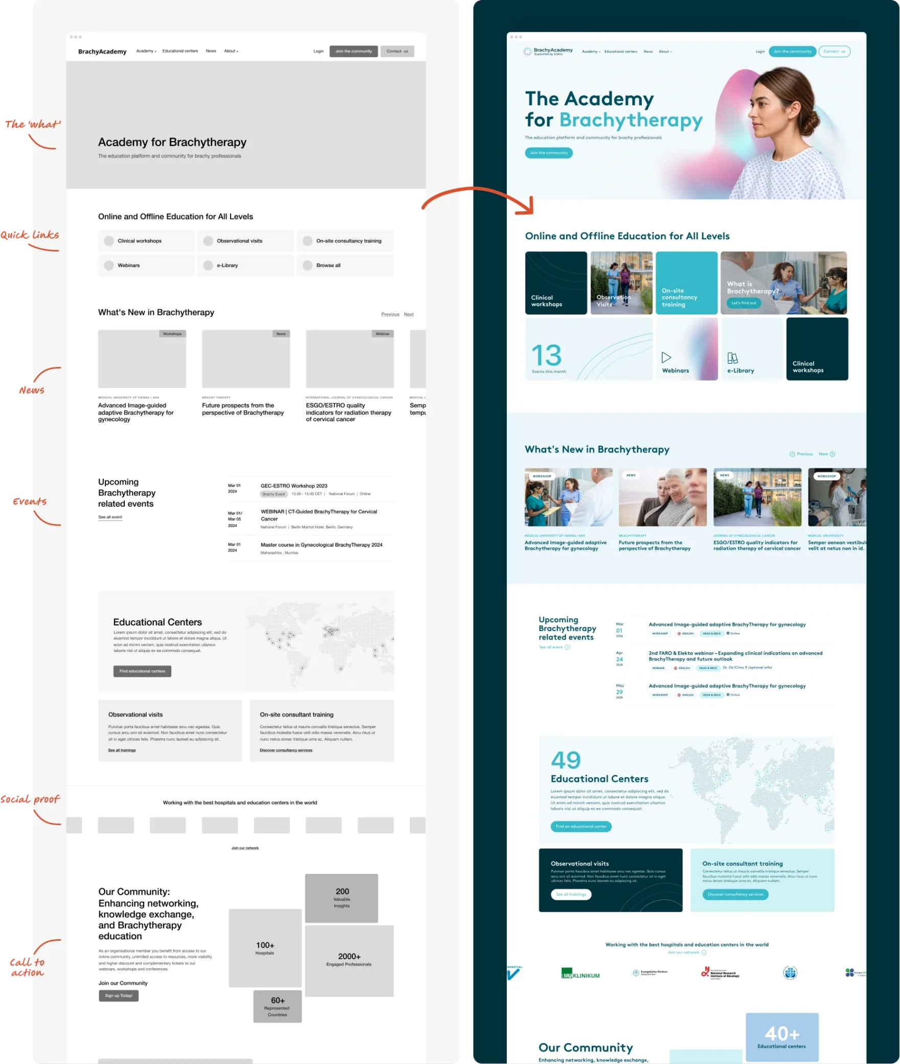 BrachyAcademy website design for Elekta